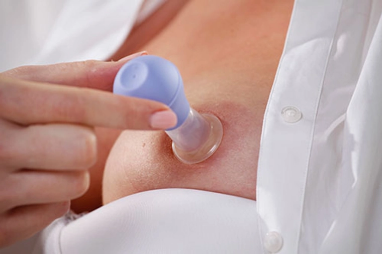 Jemné a rýchle vytvarovanie bradavky